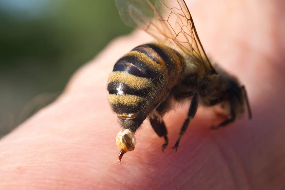 Wasp Stings: Risks and First Aid